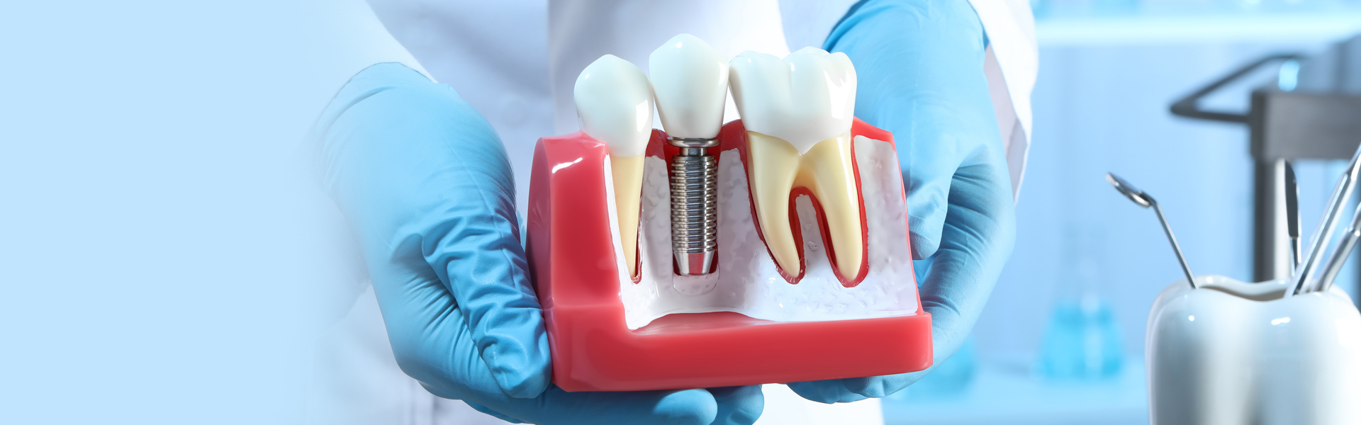 Learn How Dental Implants Can Change Your Life from the Pros